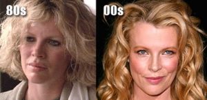 Kim Basinger latest to be hit with the plastic surgery rumor