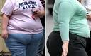 Plastic surgery blog: Obesity drug not likely to be approved