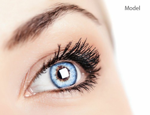 Eyelid Surgery a.k.a. Blepharoplasty