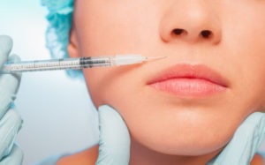 Transitioning from Fillers to a Facelift