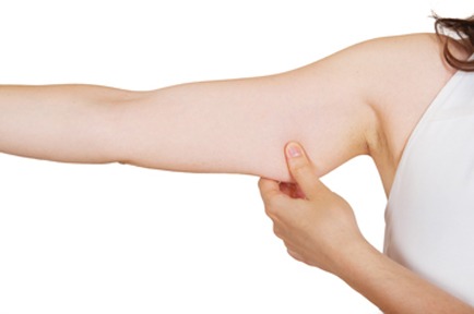 Liposuction For Your Upper Arms