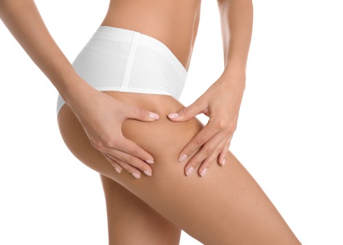 Liposuction of the flanks Beverly Hills - Smaller Waist- Flanks Lipo