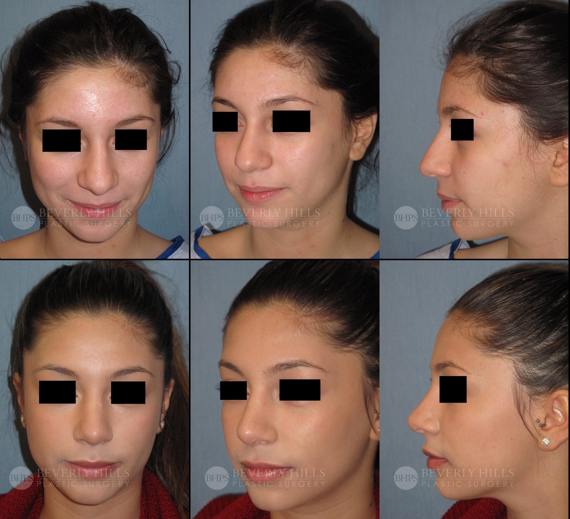 Image of patient post surgery