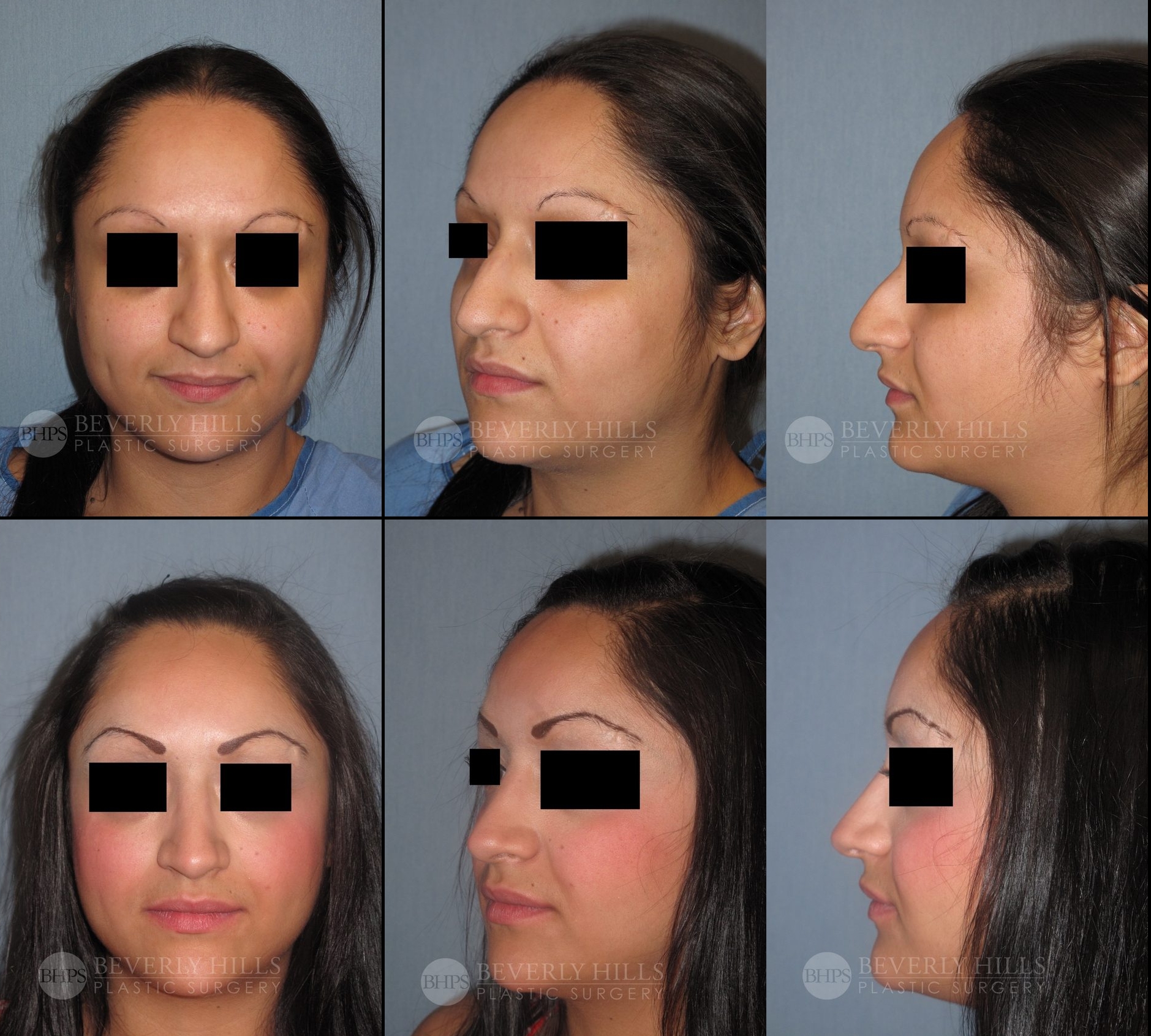 Image of patient post surgery