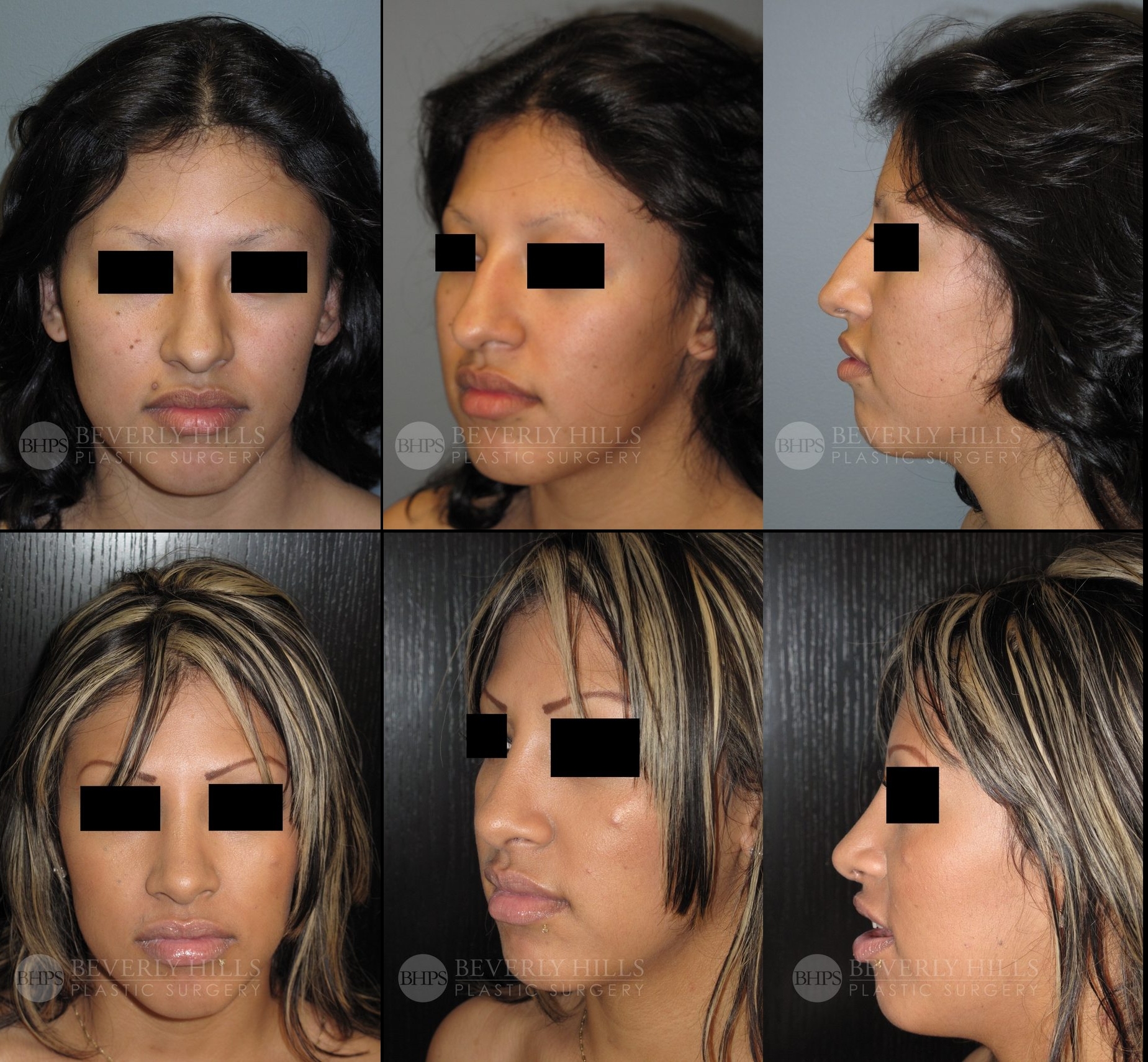 Image of patient post surgery