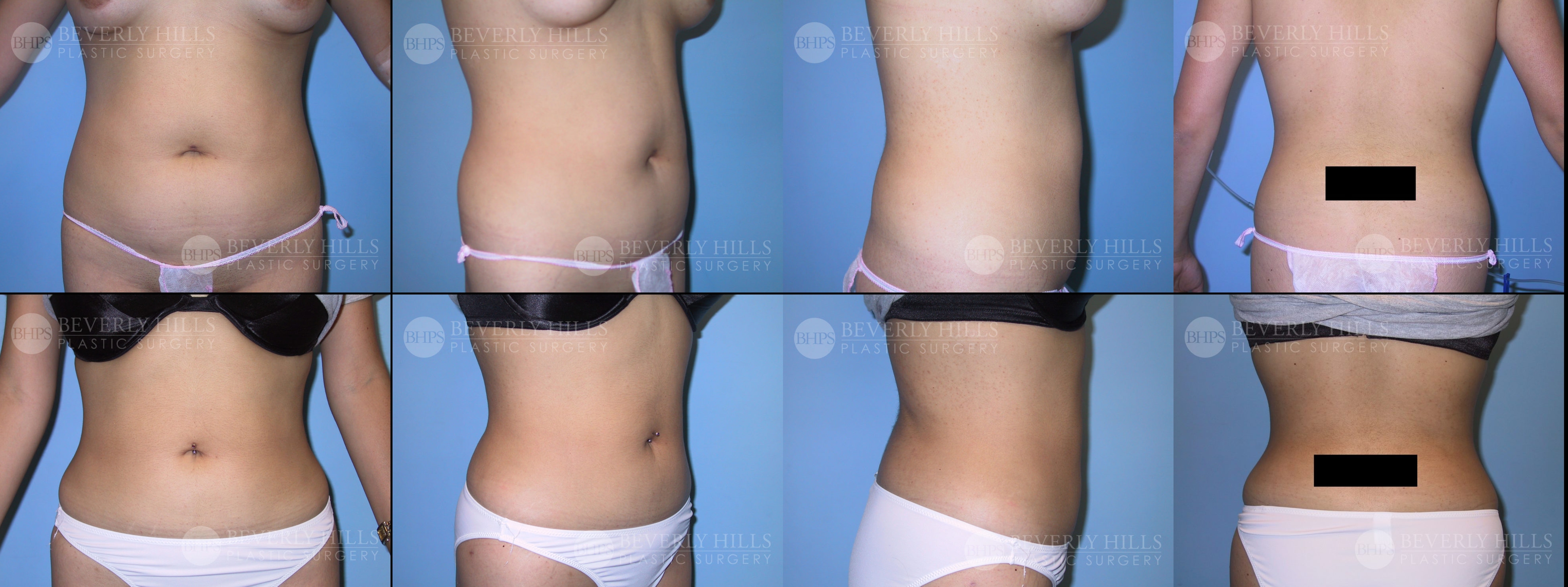 Image of patient post surgery