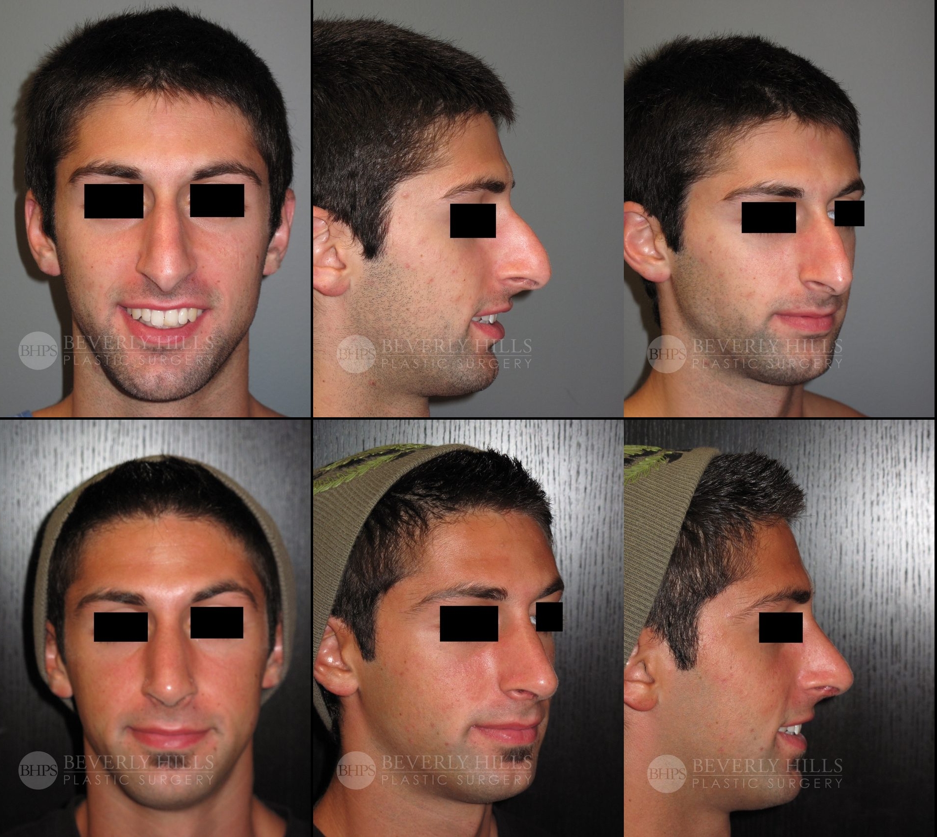 Image of patient post surgery