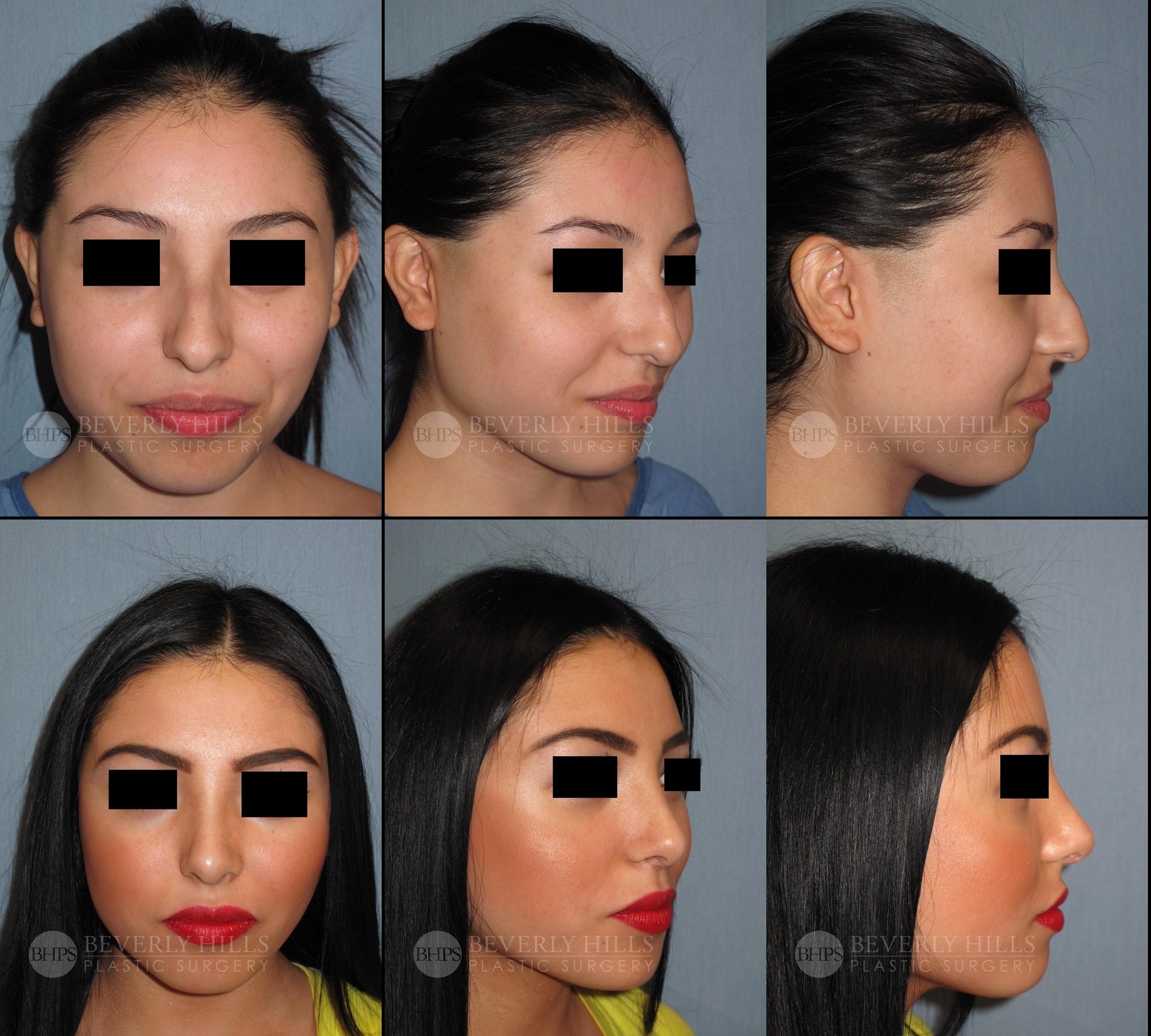 Image of patient post surgery
