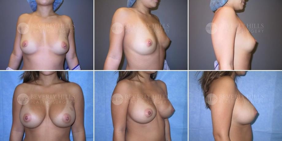 Image of patient post surgery