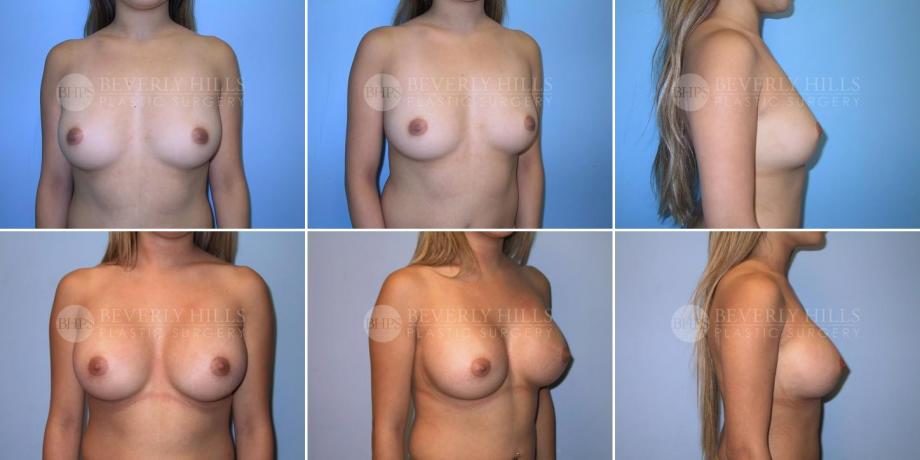Image of patient post surgery
