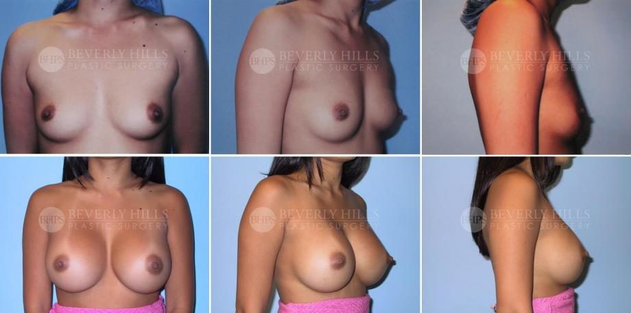 Image of patient post surgery