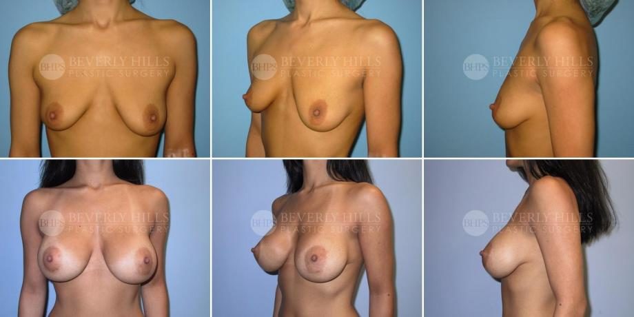 Image of patient post surgery