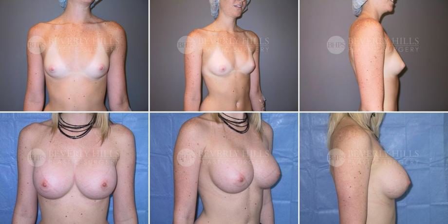 Image of patient post surgery