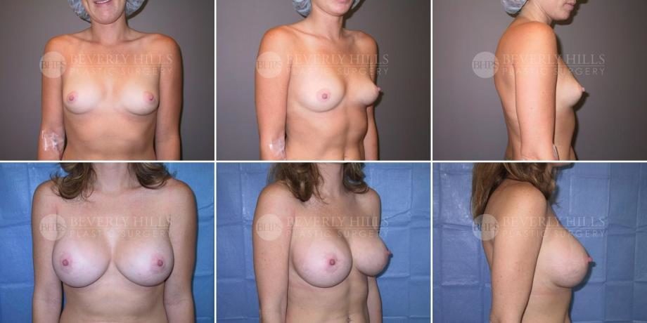 Image of patient post surgery