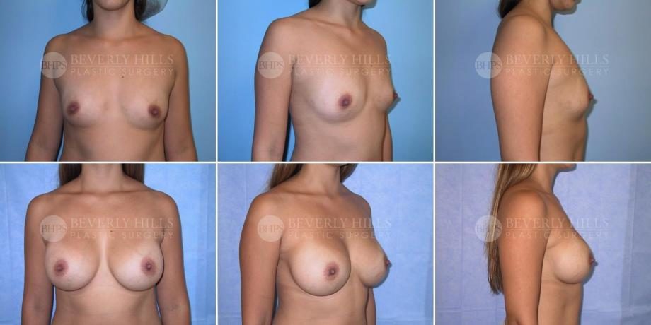 Image of patient post surgery