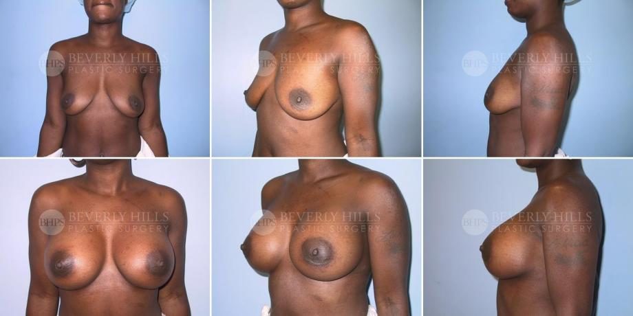 Image of patient post surgery