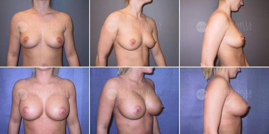 Image of patient post surgery