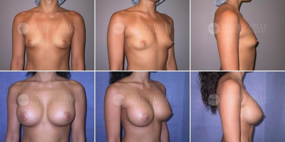 Image of patient post surgery
