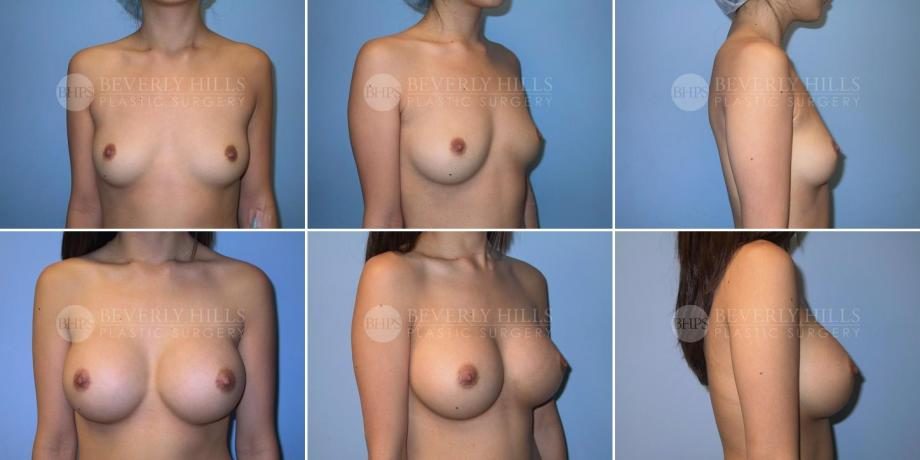 Image of patient post surgery