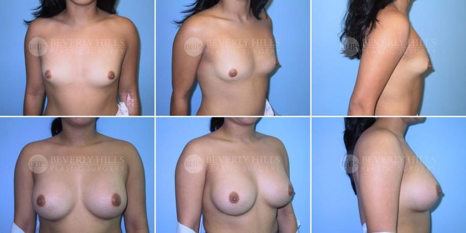 Image of patient post surgery