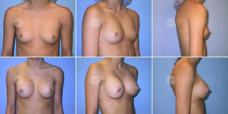 Image of patient post surgery