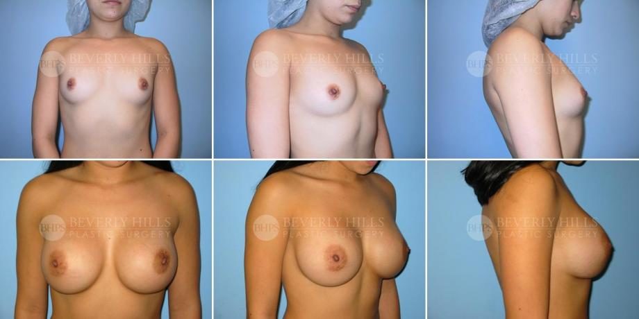 Image of patient post surgery