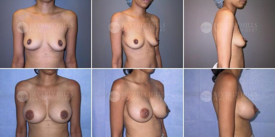 Image of patient post surgery