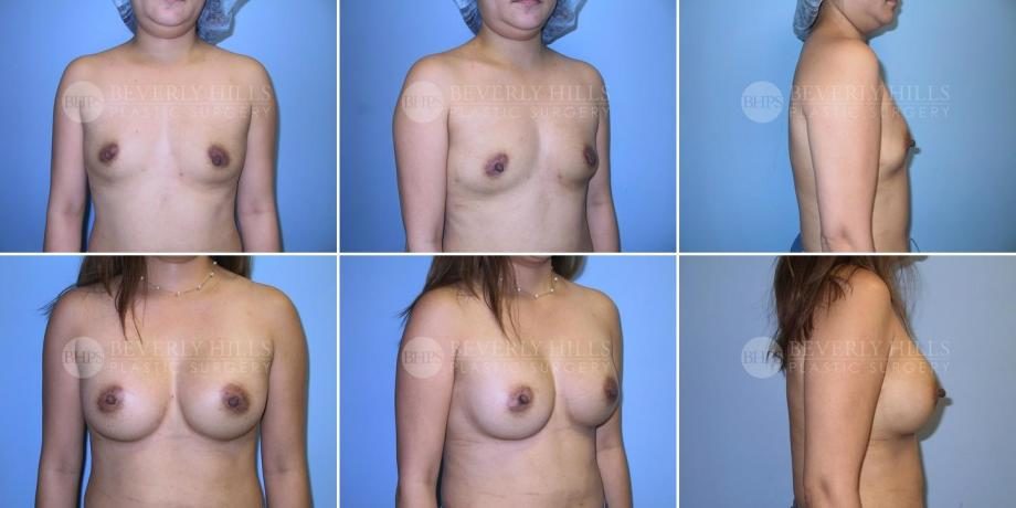 Image of patient post surgery