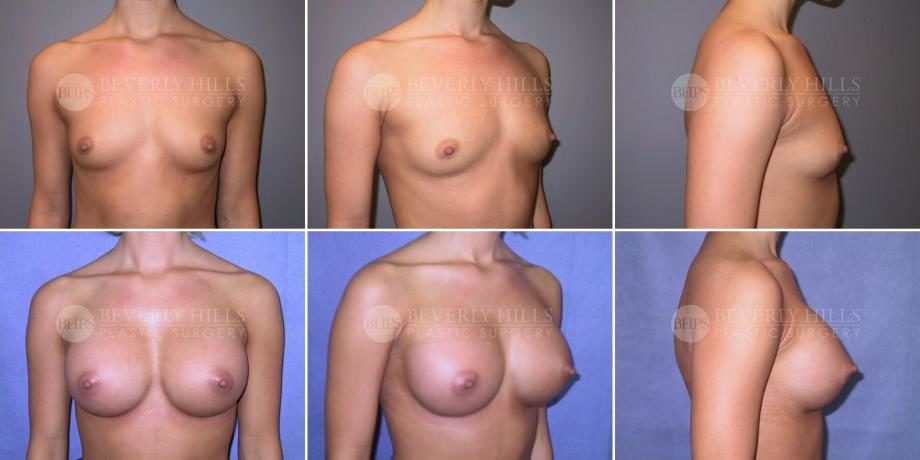 Image of patient post surgery
