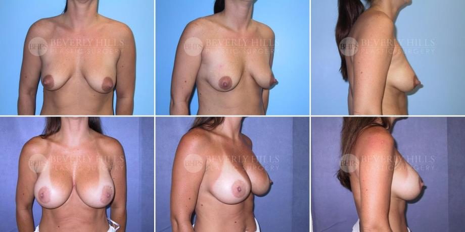 Image of patient post surgery