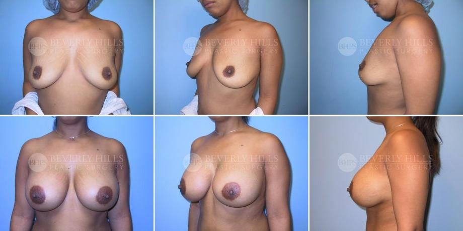 Image of patient post surgery