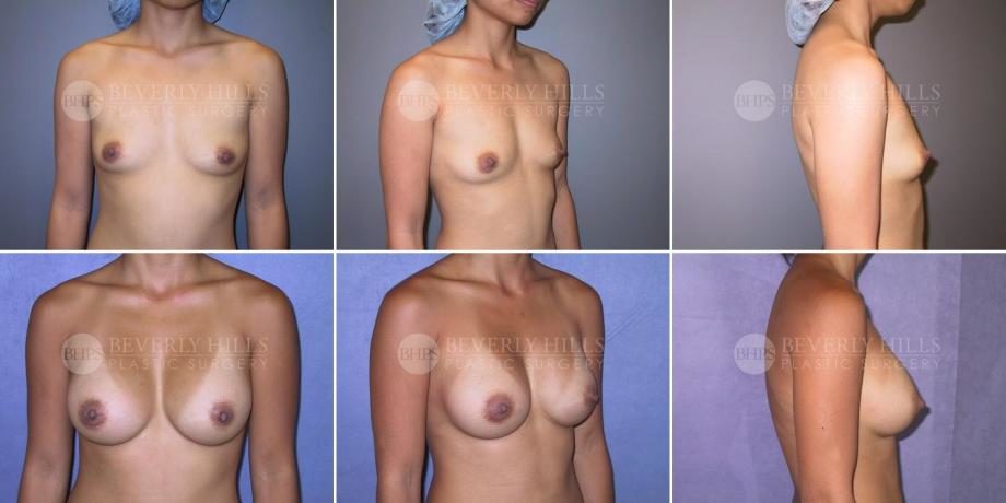 Image of patient post surgery