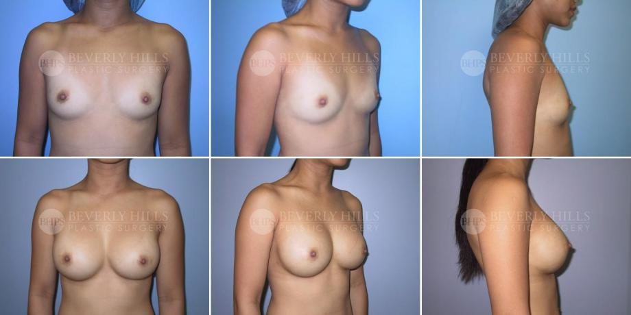 Image of patient post surgery