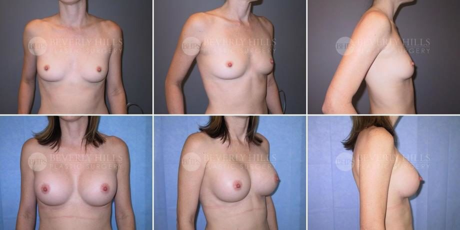 Image of patient post surgery