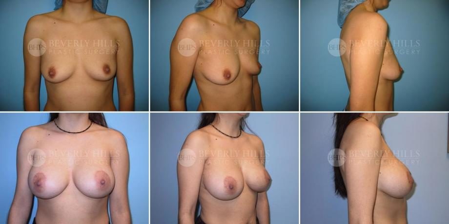 Image of patient post surgery