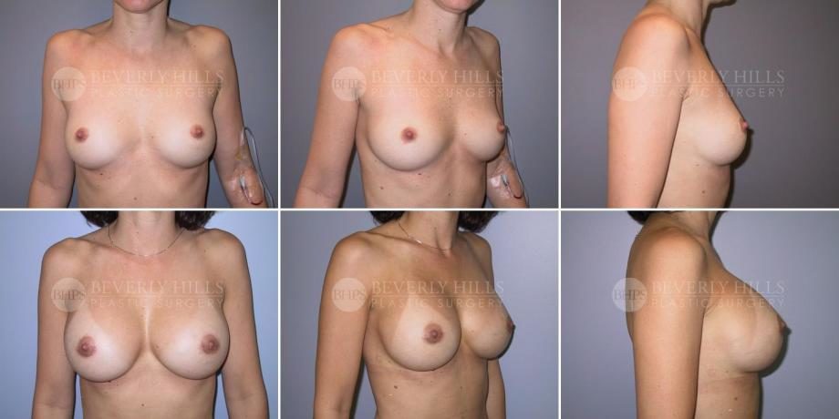 Image of patient post surgery