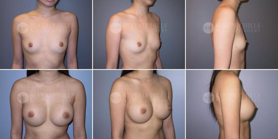 Image of patient post surgery