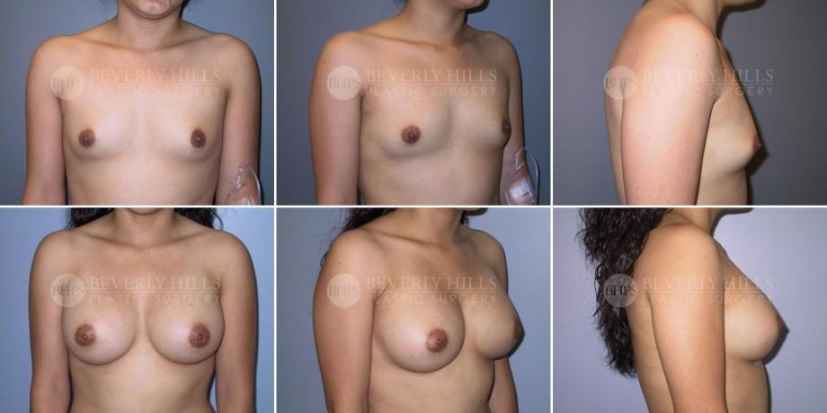 Image of patient post surgery