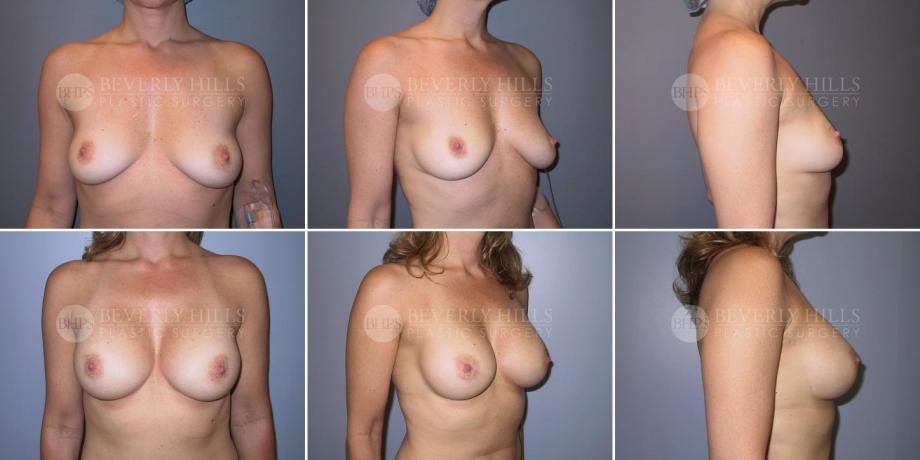 Image of patient post surgery