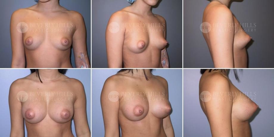 Image of patient post surgery
