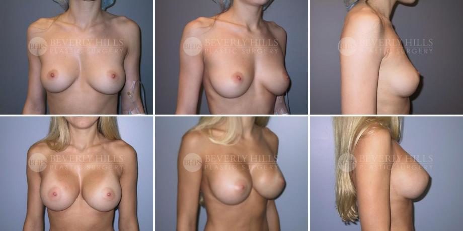 Image of patient post surgery