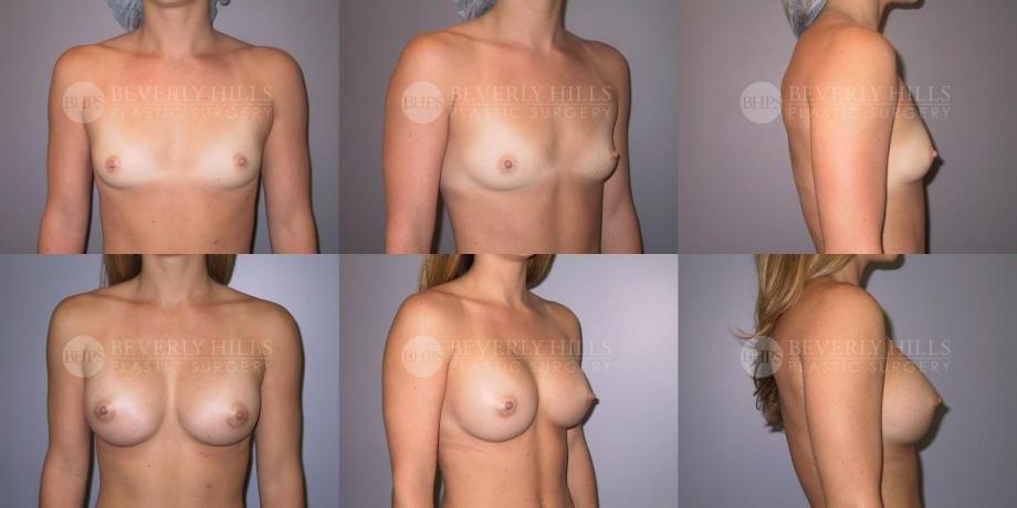 Image of patient post surgery