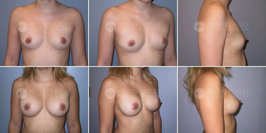 Image of patient post surgery
