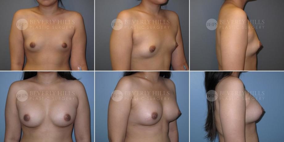 Image of patient post surgery