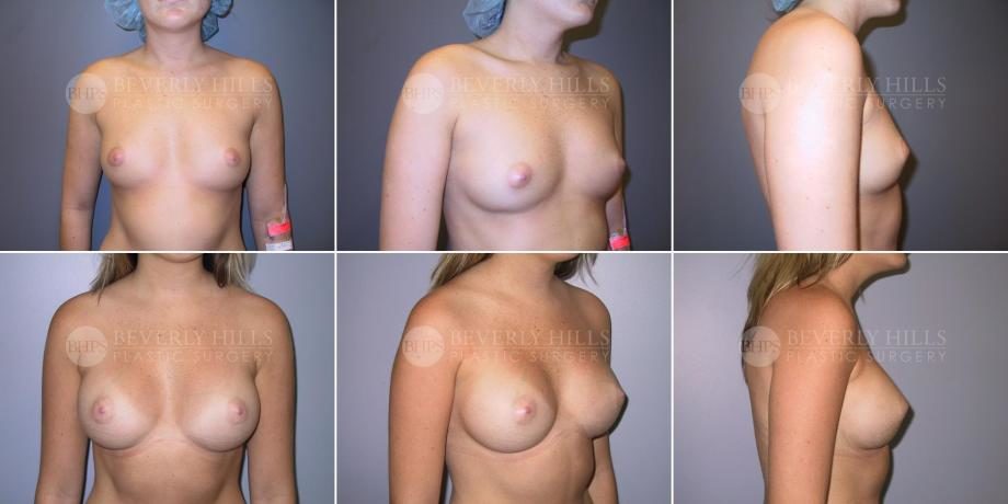 Image of patient post surgery