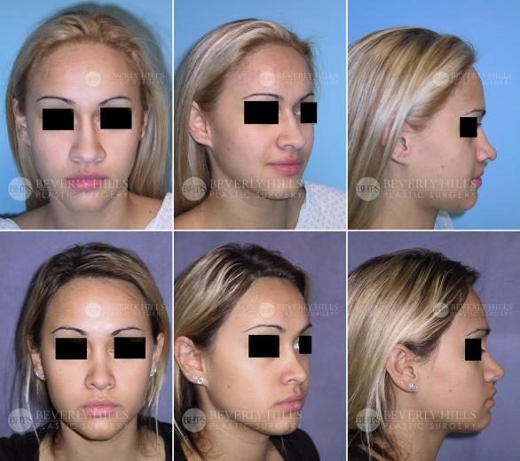 Image of patient post surgery