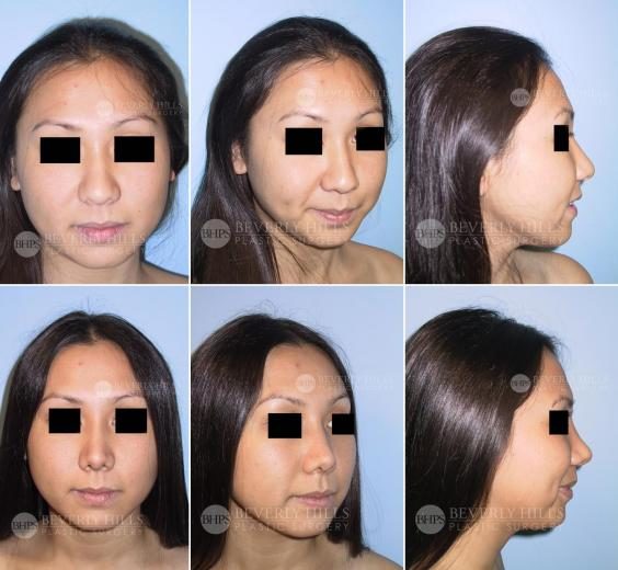 Image of patient post surgery