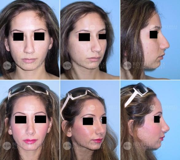 Image of patient post surgery