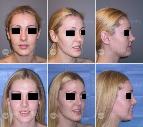Image of patient post surgery