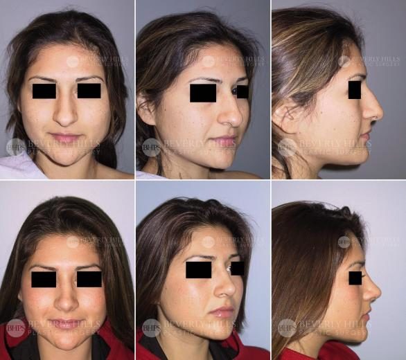 Image of patient post surgery